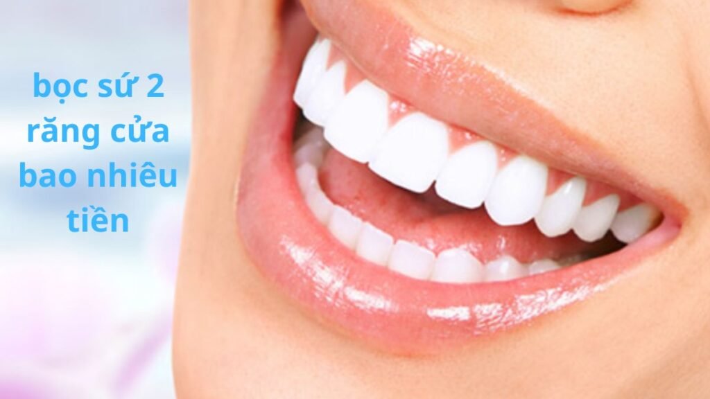 bọc sứ 2 răng cửa bao nhiêu