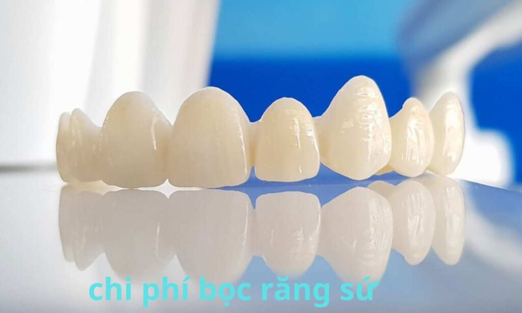 chi phí bọc sứ phụ thuộc vào chất liệu sứ