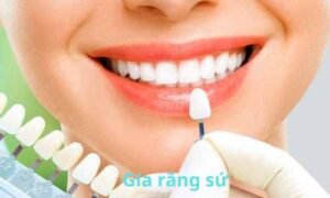 giá răng sứ