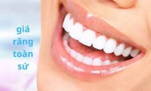 giá răng toàn sứ