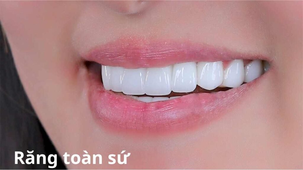 Răng toàn sứ